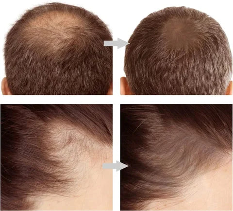 SELLO PARA CABELLO