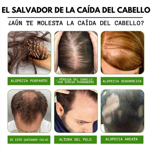 TONICO CAPILAR-TRATAMIENTO